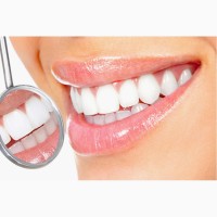 Профессиональное отбеливание зубов системой Beyond Polus Киев