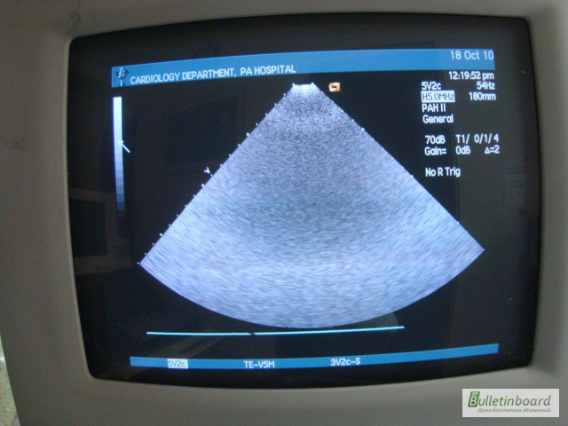 Ультразвуковой сканер Siemens Acuson Sequoia 512