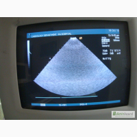 Ультразвуковой сканер Siemens Acuson Sequoia 512