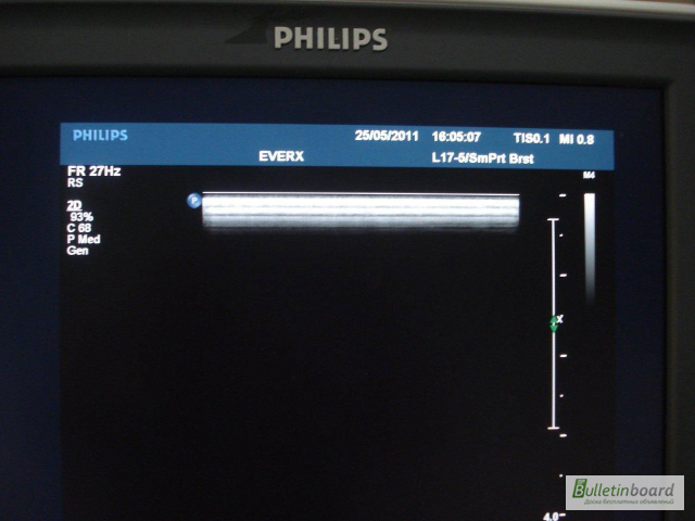 Фото 3. Ультразвуковой сканер Philips iU22, 2012 г