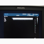 Ультразвуковой сканер Philips iU22, 2012 г