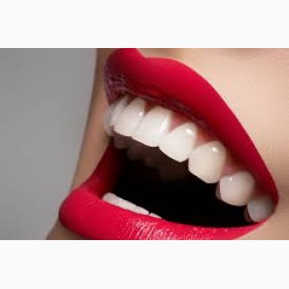Эффективное аппаратное отбеливание зубов в клинике Эстет Смайл
